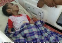 Satu Anak di Manokwari Terserang Gizi Buruk