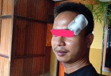 Ironis, Diduga Mabuk, Oknum Pakai Kaos dan Celana Satpol PP Aniaya Warga