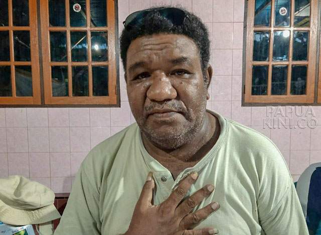 Kepulangan Masyarakat Byak Terkendala Biaya Rapid Test Covid-19 Kepulangan Masyarakat Byak Terkendala Biaya Rapid Test Covid-19