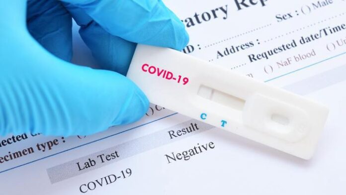 Penting, Mulai 18 Desember Syarat Masuk Jakarta Harus Rapid Test Antigen (PCR) Bukan Antibodi